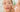 Teen years and hormonal skin