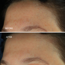 Load image into Gallery viewer, Age Benefit Hyperpigmentation Repair